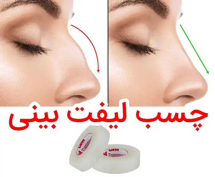 چسب لیفت بینی و شقیقه 9متری اصل